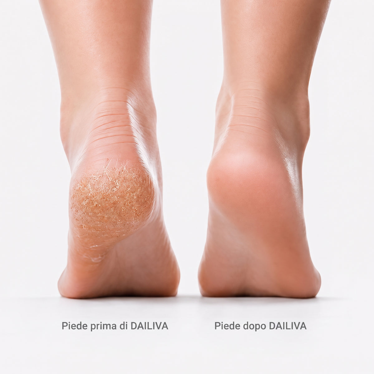 DAILIVA Rimuovi Calli Professionale