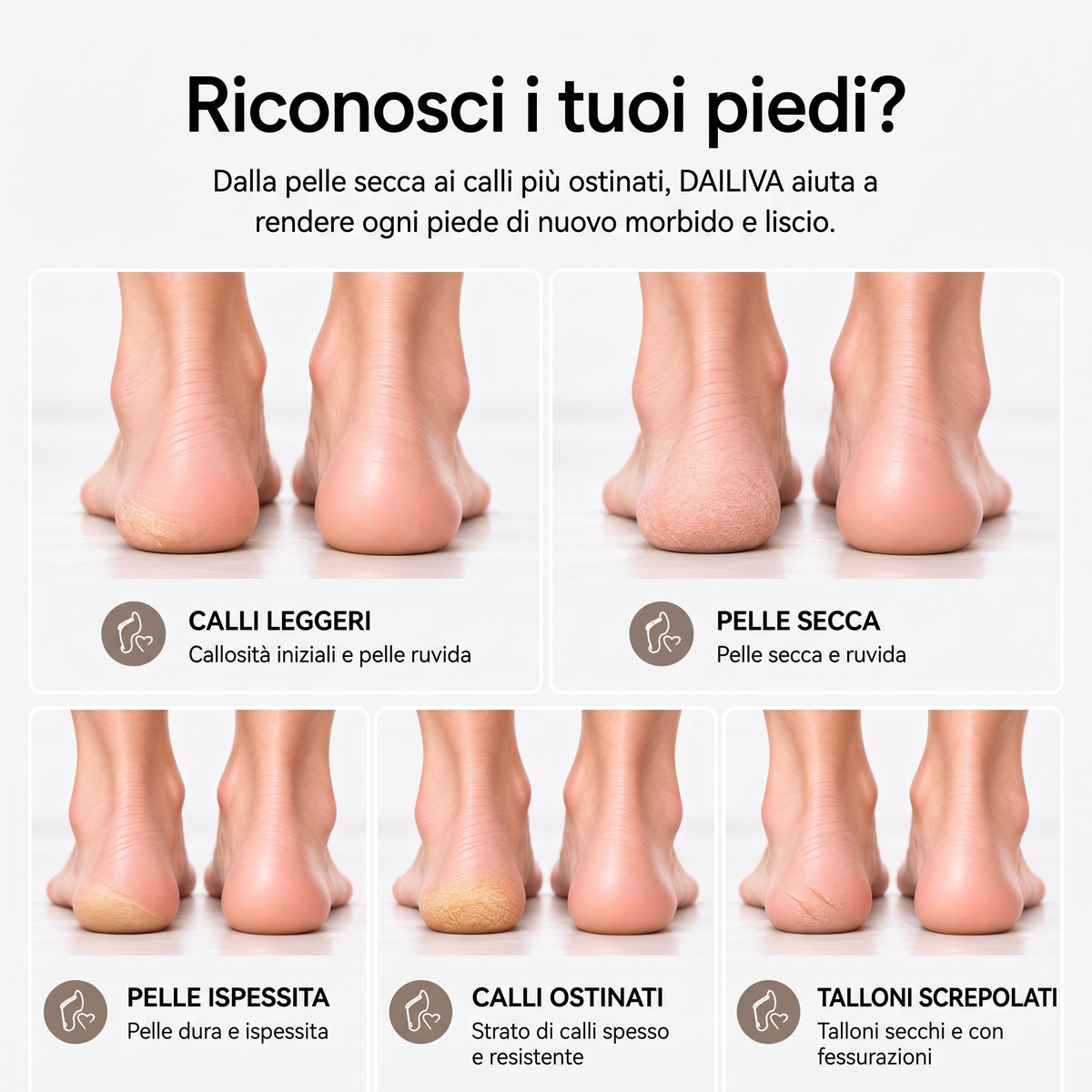 DAILIVA Rimuovi Calli Professionale