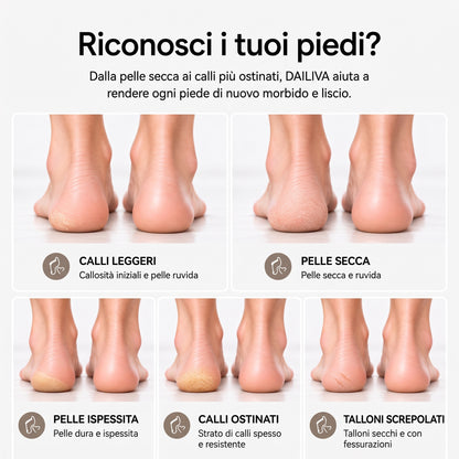 DAILIVA Rimuovi Calli Professionale